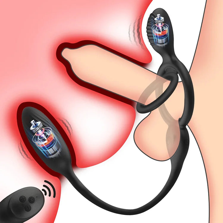 Husband And Wife Share Double Shock Male Anal Stopper Prostate Massager G-spot Vibration Sperm Locking Masturbator Adult Products